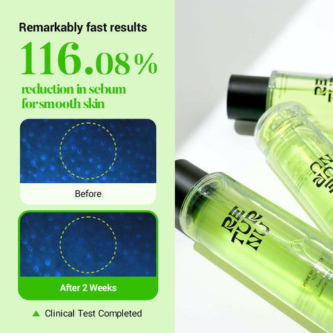 RETURNU PORESHOOTER TONER 150ml