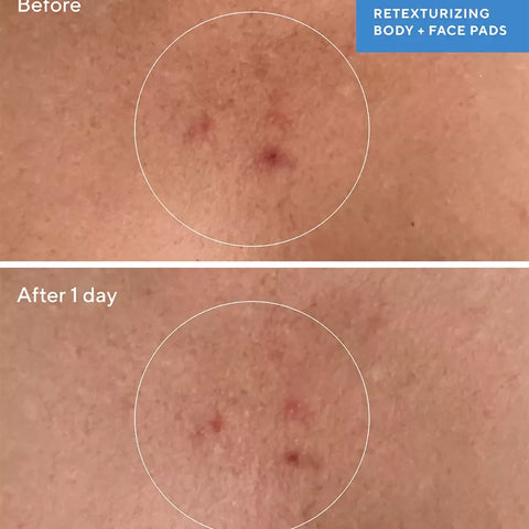 Murad Blemish Control Retexturizing Body Pads (45pcs)