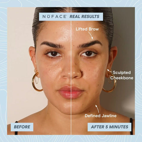 NuFACE TRINITY+® Starter Kit - Sandy Rose Pink