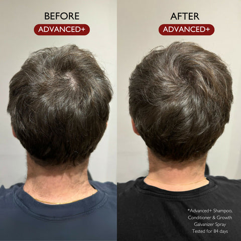 Daimon Barbers Hair growth galvanizer 100ml