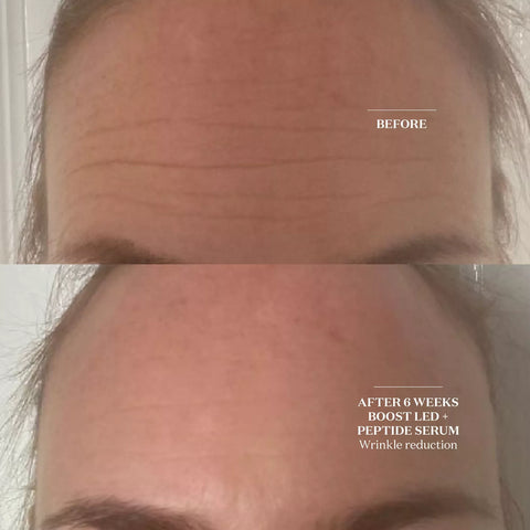 Light Salon Boost Advanced LED Mask